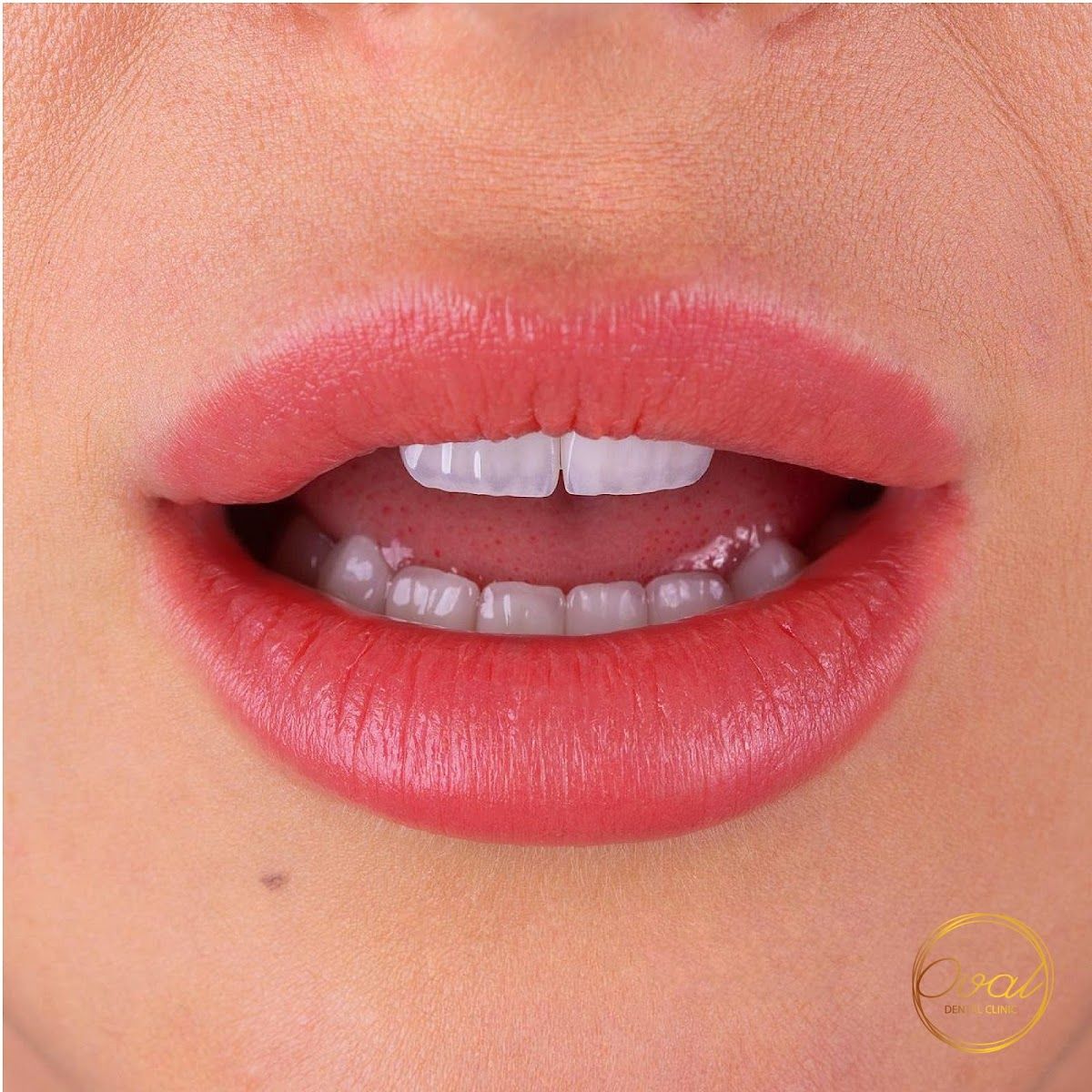 Oval Dental Clinic LLC