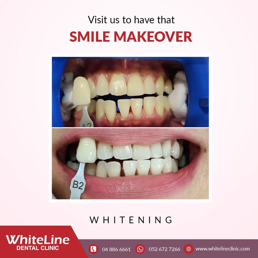 White Line Dental Clinic LLC